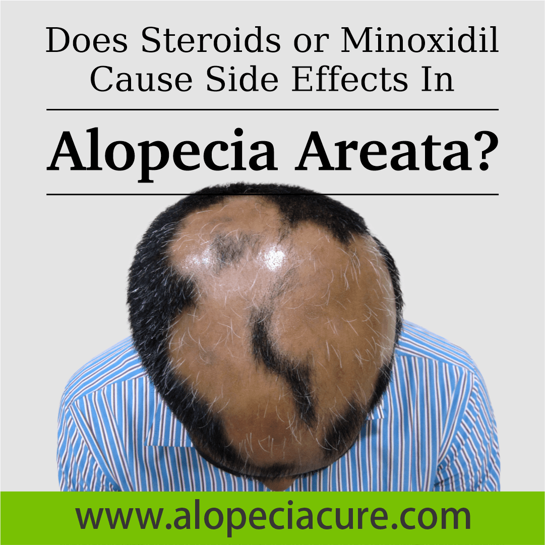 side effects of minoxidil